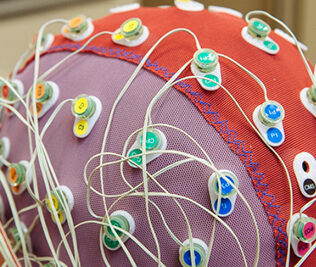 Electroencephalography